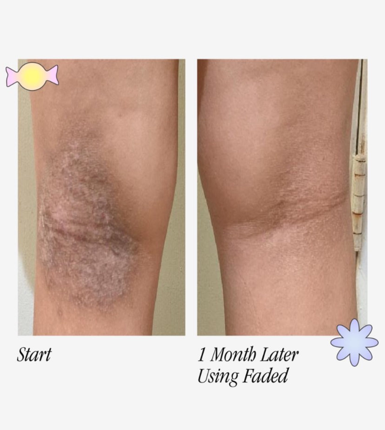 TOPICALS Traitement en spray anti-tâches Faded