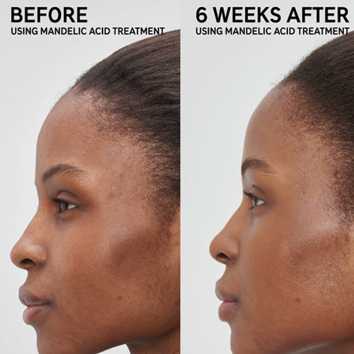 THE INKEY LIST Soin anti-tâches et marques à l’acide mandelique