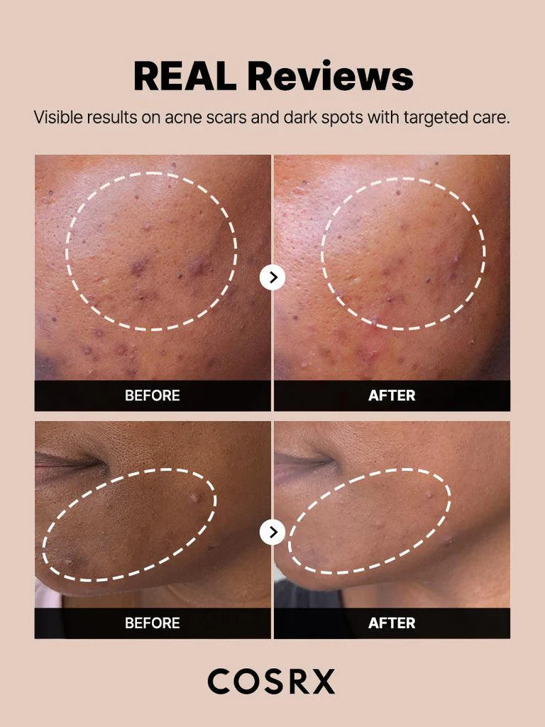 COSRX Sérum anti-tâches The Alpha Arbutin 2 Discoloration