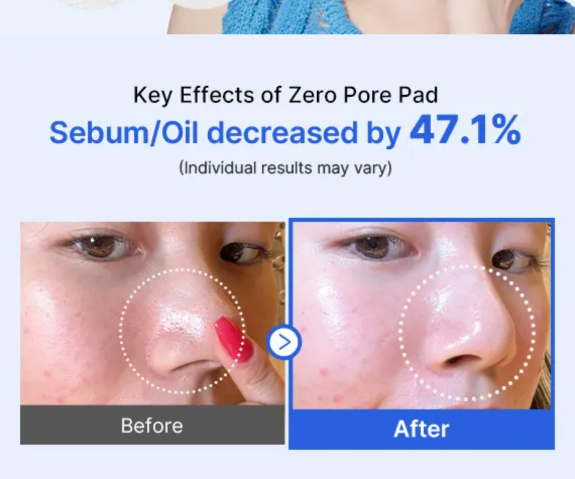 MEDICUBE Disques exfoliants anti pores dilatés Zero Pores Pad