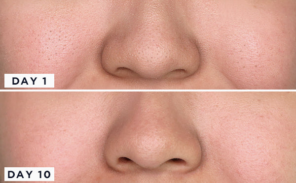 COSRX Soin anti pores dilatés Two in One Poreless Power Liquid
