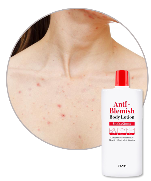 TIAM lait de corps exfoliant Blemish lotion