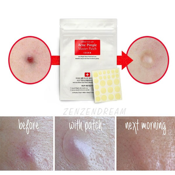 COSRX Master Pimple Patch anti-acné