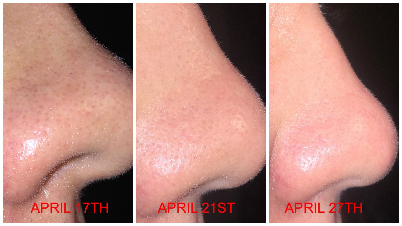 PAULA'S CHOICE Lotion Tonique Matifiante Anti-pores Visibles Pore Reducing