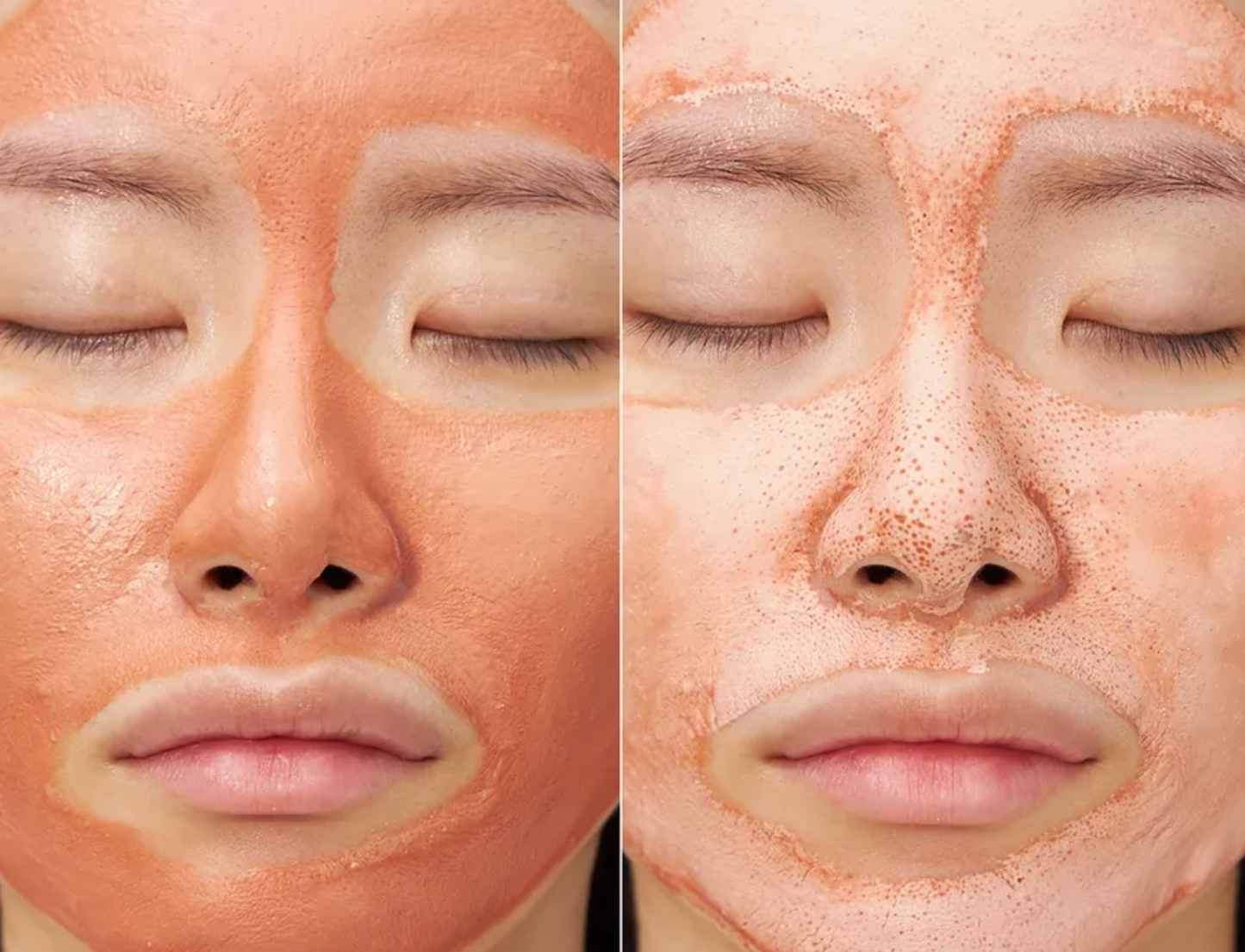 APRIK SKIN Masque anti-pores dilatés argile carrotène