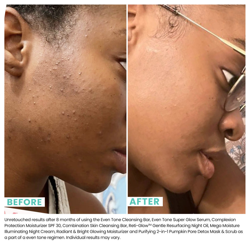 URBAN SKIN Rx Masque exfoliant mécanique aux AHA 8% Brighterdays Dark spot