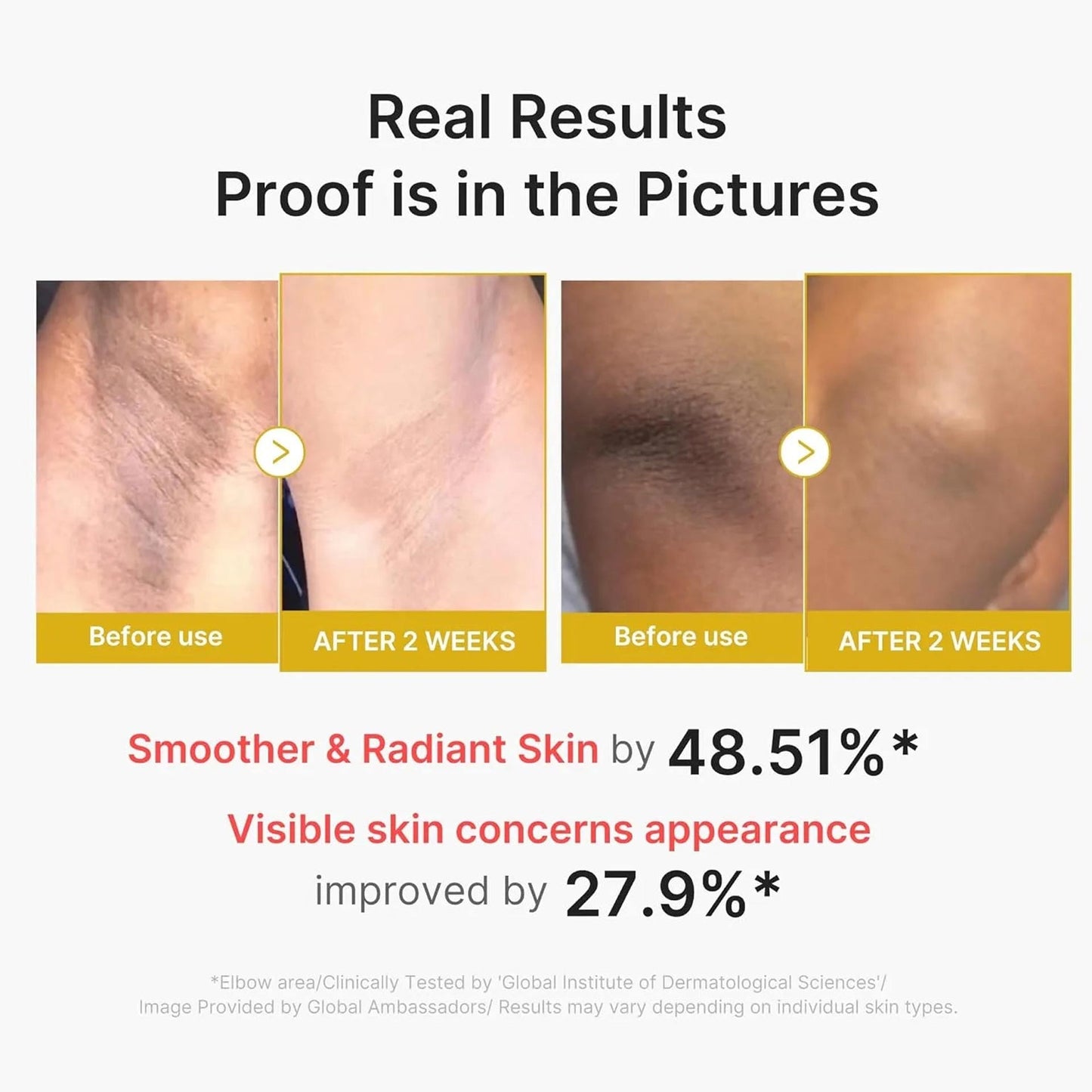 MEDICUBE Turmeric Body Peel Shot Soin Peeling éclaircissant corporel au Curcuma et Acide Kojique