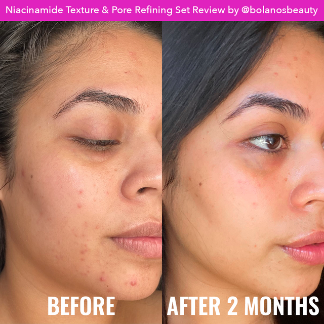 GOOD MOLECULES Duo anti-pores dilatés et tâches