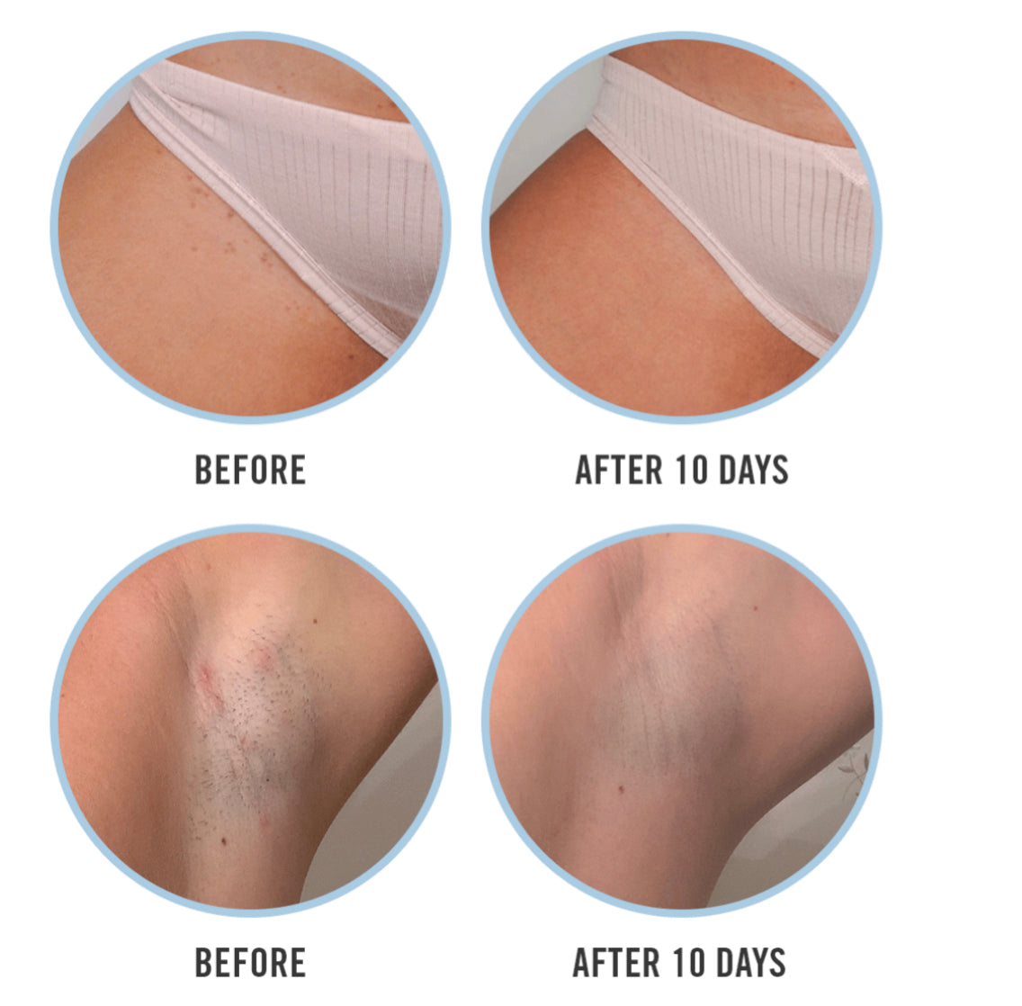 FIRST AID BEAUTY Disques anti poils incarnés